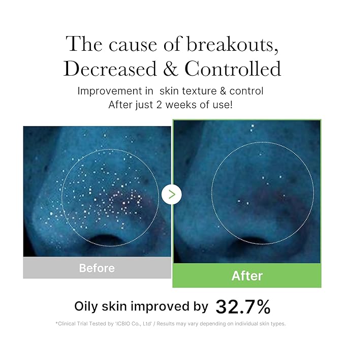 medicube Exosome Cica Toner | Daily Soothing Toner With Exosome Cica, Heartleaf, Tea Tree, 12 Kinds of Cica | Low Irritation, Sebum care Korean Skin Care, for Stressed Skin (210ml / 7.10 fl.oz.)