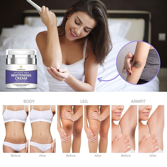 FAMIROSA Intimate Area Dark Spot Corrector: Underarm Cream for Armpit, Knees, Elbows, inner Thigh, Private Parts - Intimate Skin Cream 50 ml
