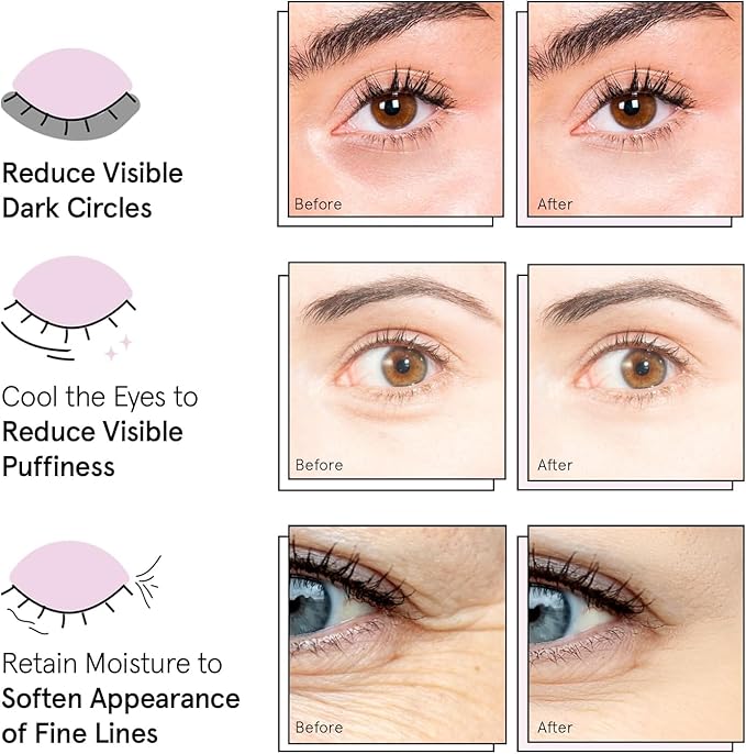 grace & stella Award Winning Under Eye Mask - Reduce Dark Circles, Puffy Eyes, Undereye Bags, Wrinkles - Gel Under Eye Patches - Gifts for Mom - Vegan Cruelty-Free Self Care (Pink, 6 Pairs)