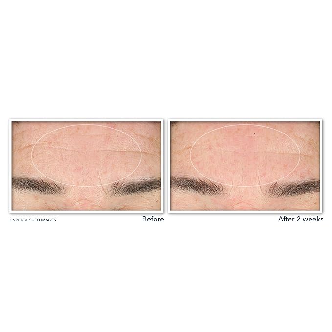 RoC Retinol Correxion Deep Wrinkle Serum Facial Cleanser with Niacinamide for Anti-Aging & Fine Lines,Makeup Remover,Ophthalmologist Tested Skin Care,6 oz,(Pack of 2)