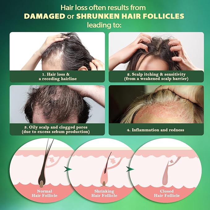 Hair Growth Serum for Thicker Hair: Lightweight Scalp Essence for Hair Growth Roller for All Hair Types Refreshing Botanical Formula (2 Pack (2 * 20ml))