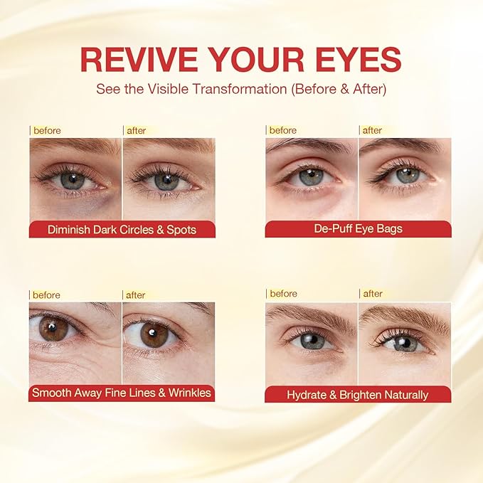 GONIM Under Eye Patches 360° Fit, Eye Mask with Collagen Peptide, Salmon DNA PDRN, Retinol & Niacinamide, Eye Patches for Puffy Eyes and Dark Circles, Travel Essentials 4 pairs x 2