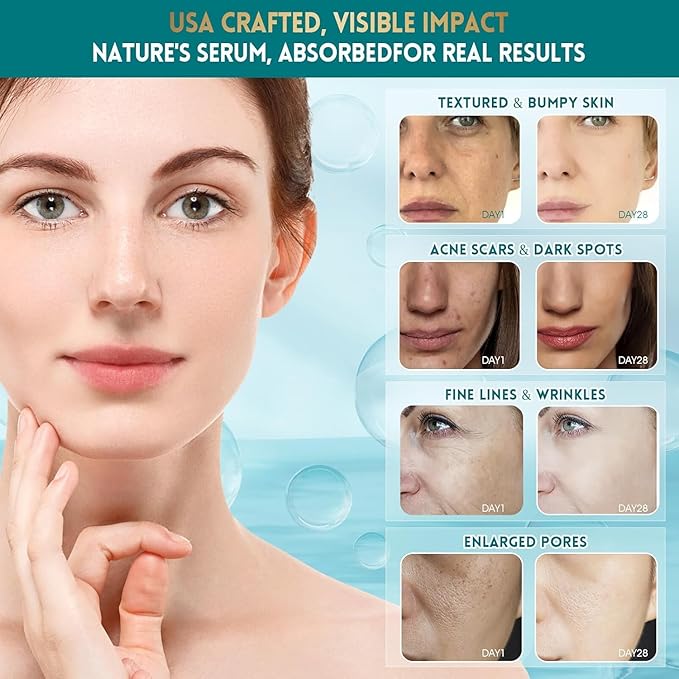 Eye Serum – Dark Circle & Puffiness Care, Smooths Fine Lines with Niacinamide, Caffeine & Hyaluronic Acid – Lightweight, Comfortable Formula for All Skin Types, 0.96 FL.OZ