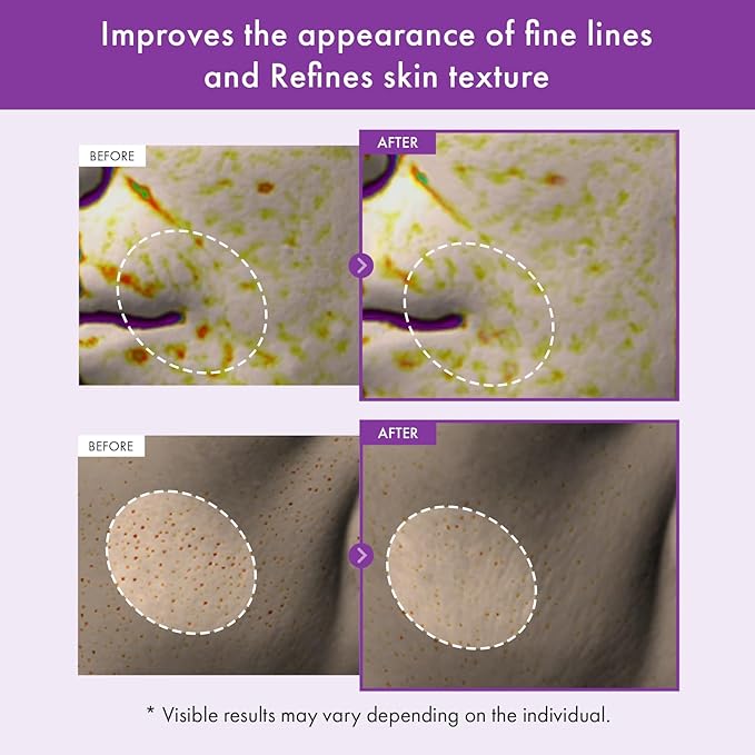 TOSOWOONG Real Retinol 0.1% Night Cream, Anti-Aging Face Moisturizer with Retinol, Bakuchiol, Firmer Skin, Reduce Wrinkles and Pore Minimizer | Korean Skincare for Face & Neck, 50ml / 1.69 fl. oz.