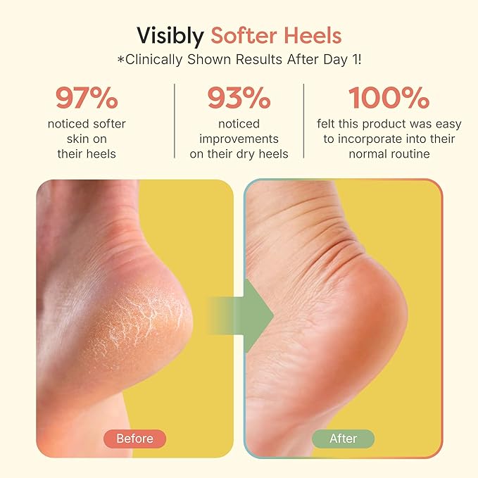 ZenToes Moisturizing Socks for Cracked Heel Treatment, Vitamin E, Olive Oil and Jojoba Oil Heel Socks, Stocking Stuffers for Women, Spa Self Care Gifts for Women (Fuzzy Lilac Purple, Regular)