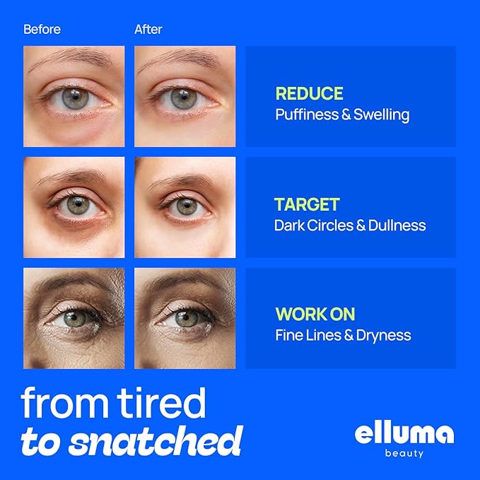 Under Eye Patches 12 Pairs of Themed Hydrogel Eye Gel Pads - For Puffy Eyes and Dark Circles, Under Eye Bags, Wrinkles - Restoring Set with Chamomile