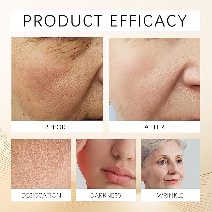 New Perfection Eye Tightener, Gentle Skin eye tightener, Instant Temporary eye tightener Cream, Reduces The Look of Under eye Bags, Dark Circles & Puffiness, Anti-Aging Fine Lines (2 Bottle)