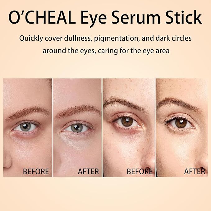 O'CHEAL Eye Serum Stick, Hydrating, Nourishing, Brightens, Tightens, Reduces Dark Circles & Eyes Pigmentation, Improves Dullness, Bags Remover Under Eye Cream, Lifts and Firms Skin, Easy to Absorb