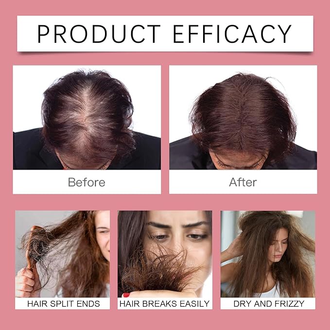 Advanced Hair Regrowth Serum for Scalp 50ml, Hair Growth Oil Spray Promotes Hair Growth and Strengthening - Non-Greasy, Hormone-Free, Fast-Absorbing Formula – Fights Hair Thinning & Hair Loss