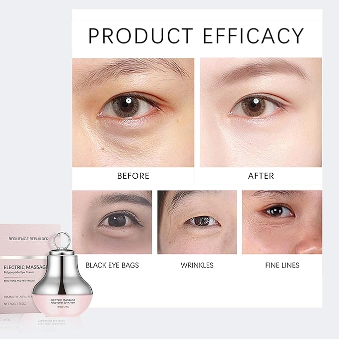 Electric Massage Eye Cream for Dark Circle, Firm and Smooth of Fine Lines Tired, Relief Wrinkles & Puffiness with Gentle Vibration, Eye Cream for Firming, Moisturizing, Anti-Wrinkle (1)