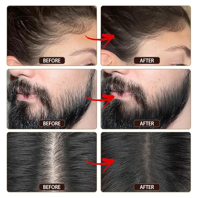 VOLLUCK Root Touch up Powder, Instant Hairline Powder for Thinning Areas and Gray Hair Coverage, Natural and Non-greasy Root Cover up for Women and Men (Dark Brown, 0.35 Ounce)