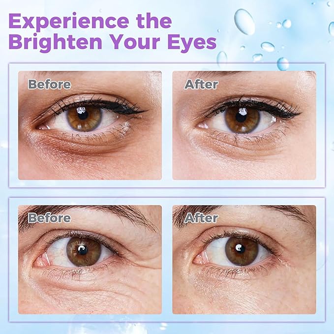 Eye Cream for Dark Circles– Revitalizing Formula with Retinol, Caffeine, Hyaluronic Acid, Peptides & Plant Extracts to Smooth Fine Lines