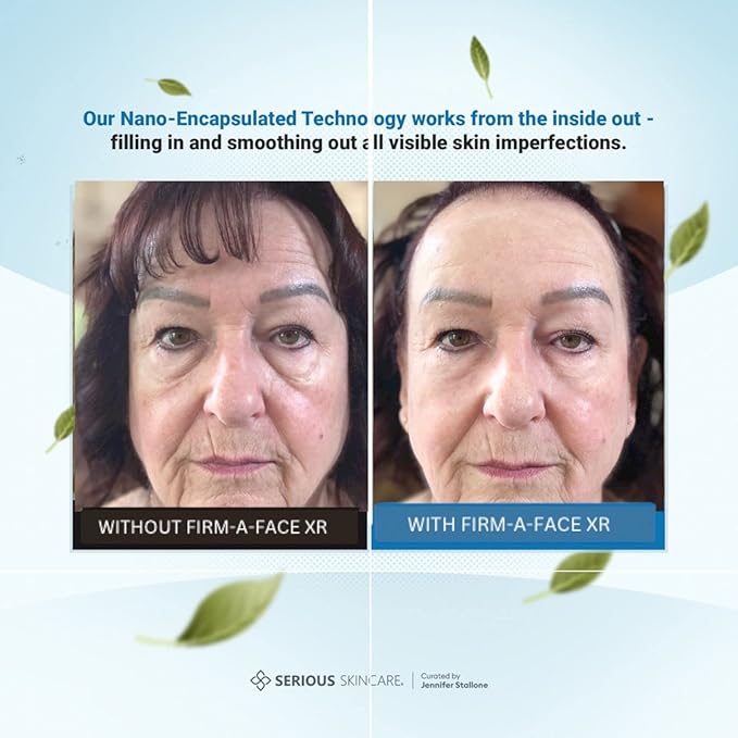 Serious Skincare Firm A Face XR - Instant Temporary Skin Tightener - Invisible Lift for Face and Neck with Retinol - Anti-Aging to Reduce the Look of Fine Lines, Wrinkles and Large Pores - 3.2 Fl Oz