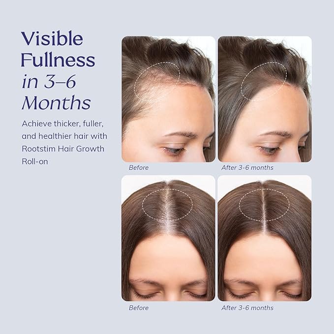 Hair Growth Serum Roll On with Rosemary, Caffeine & Biotin, Helps Support Fuller-Looking Hair, Clean Non-Greasy Scalp Serum for Thinning Hair 1.08 Fl Oz