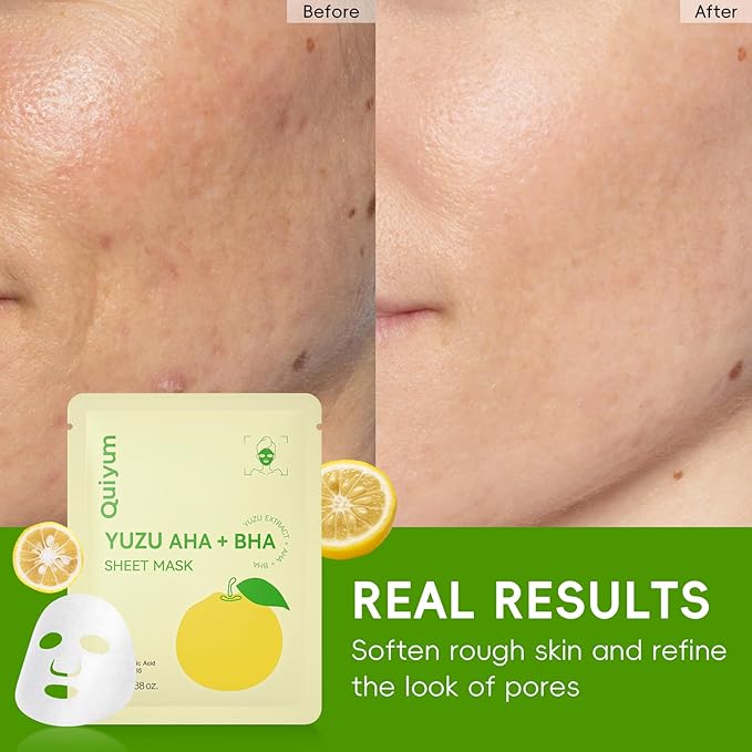 Yuzu AHA BHA Skincare Set for Teens & Young Women - 3.53oz Foaming Cleanser + 5 PCS Exfoliating Sheet Masks + 2.12oz Hydrating Gel Moisturizer | Gentle Exfoliation, Oil Control & Glowing Skin