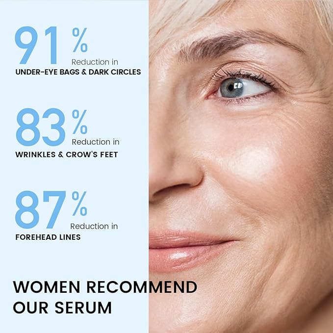 RONKIE Instant Eye Lift Cream: Reduces Eye Bags Wrinkles Puffy Eyes Dark Circles Crow’s Feet in Minutes for Mature Skin of Middle-aged Women 1 Fl Oz (Light)