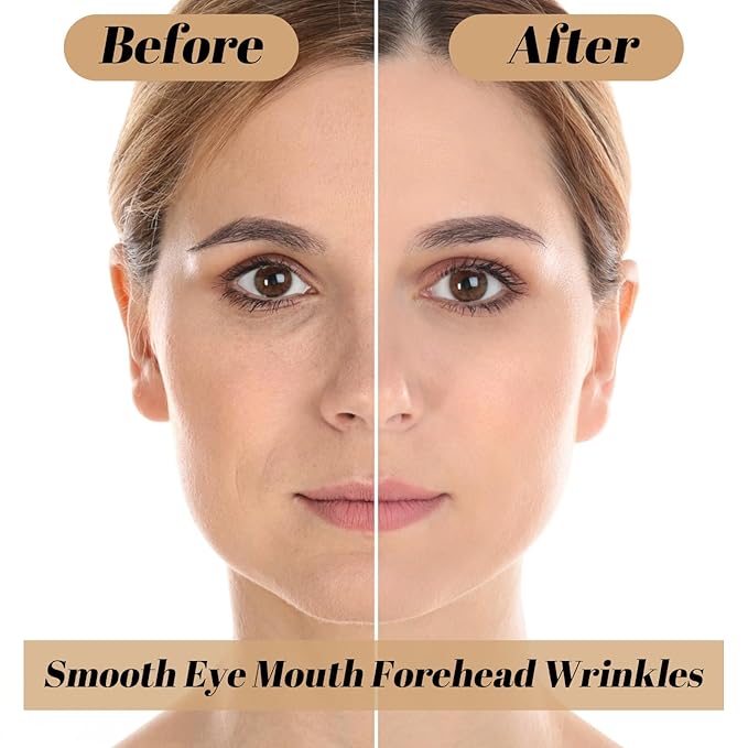 10Pcs Facial Patches Face Tape, Non-Invasive Wrinkle Tape for Face, Japanese Faces Tapes,Overnight Wrinkle Remover, High Elasticity Multifunctional Wrinkles Forehead Eyes Faces (Beige, 2.5cm)