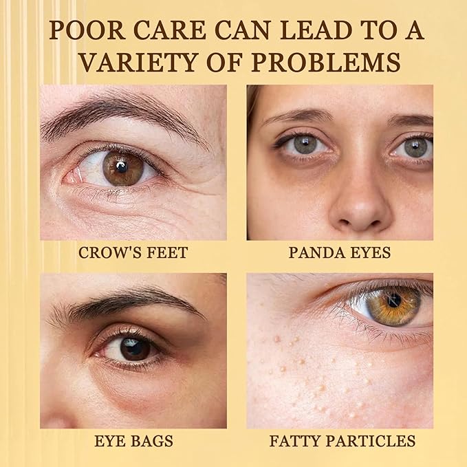 30 Pairs Under Eye Patches,Hydrating Under Eye Masks,Various Moisturizing Undereye Mask Patches for Eye Care,Travel Eyemask Skincare Eye Pads for Dark Circles,Birthday Gifts for Women