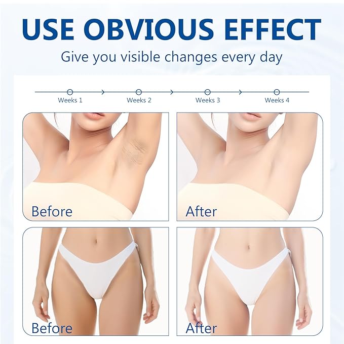 Skin Bleaching Cream, Intimate Areas, Underarms, Knees, Elbows, Inner Thighs and Bikini Areas, Daily Skin Care for Women, Skin Lightening Cream for Dark Spot, Safety & Mild Formula