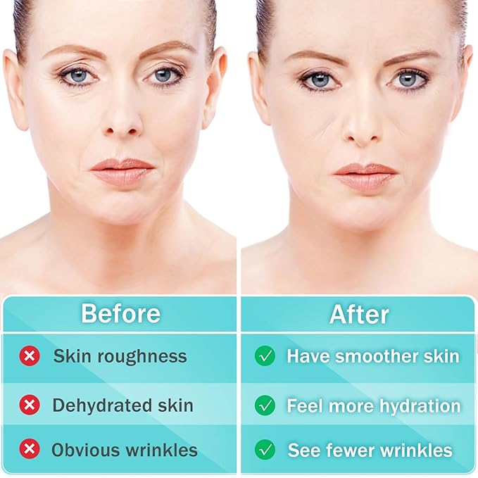 Face Wrinkle Patches Overnight, 208Pcs Wrinkle Tape for Face & Forehead, Anti-Wrinkle Facial Patches for Sleep, Face Tape for Wrinkles, Forehead & Smile Lines Patches, Comfortable Stay-On Design
