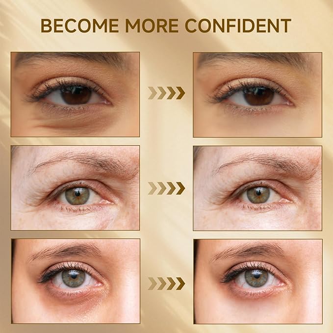 Instant Eye Tightener, Temporary Instant Visibly Reduces Wrinkles Dark Circles Under Eye Bags and Wrinkles Filler, Fine Lines Tightening and Lifting Cream for Women Men,1 FL Oz(Pack of 1)