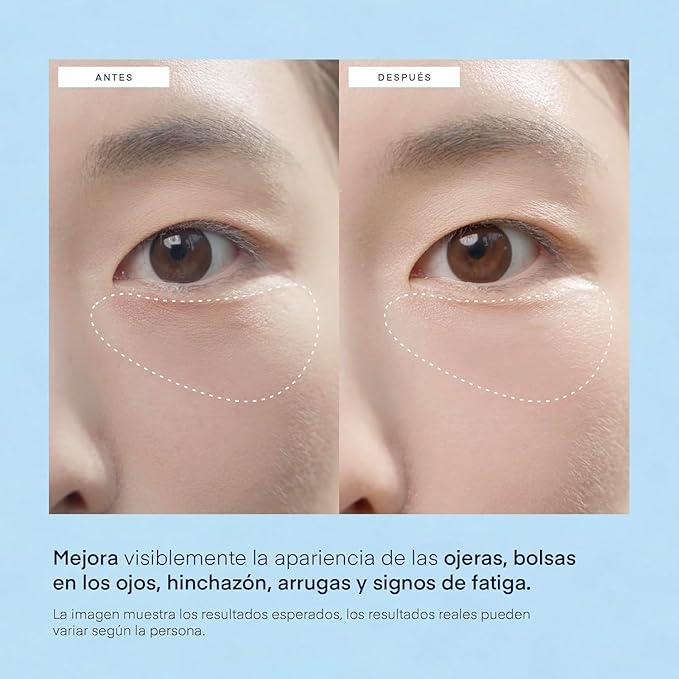 Under Eye Patches for Dark Circles & Puffiness – 60 Korean Hydrogel Masks with Caffeine, Hyaluronic Acid, Niacinamide – Vegan, Fragrance-Free, Cooling Eye Treatment for Bags & Fine Lines