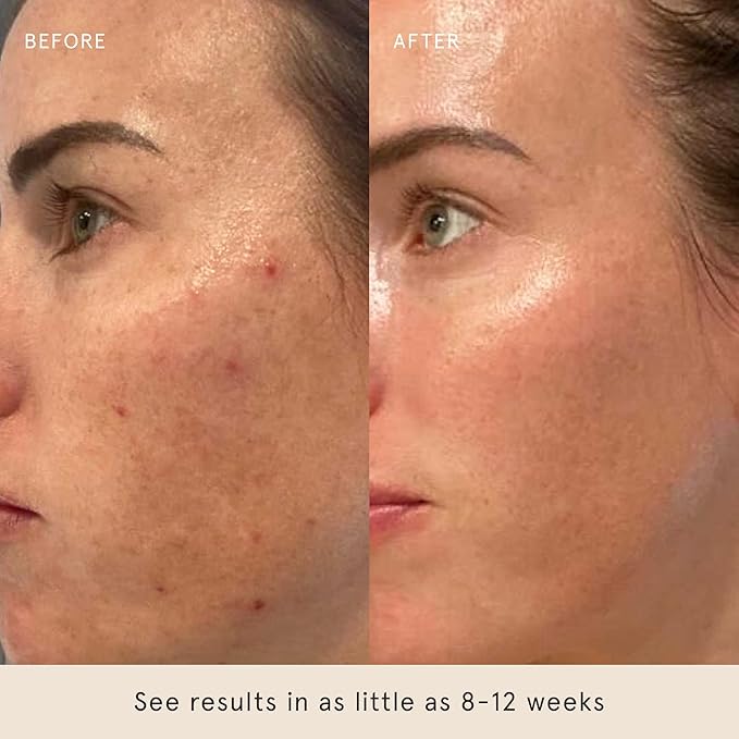 Barefaced Smooth Skin Trio - Toning Pads, Liquid Gold, RetinAL - Smoothe, Hydrate, and Brighten Skin