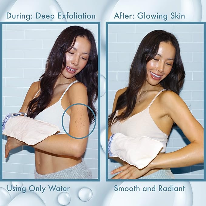 MicrodermaMitt Original Deep Exfoliating Mitt for Body - Premium Turkish Kessa Dead Skin Remover & Body Exfoliator for Keratosis Pilaris & Self-Tan Removal, Natural Skin Care Glove for Smooth Skin