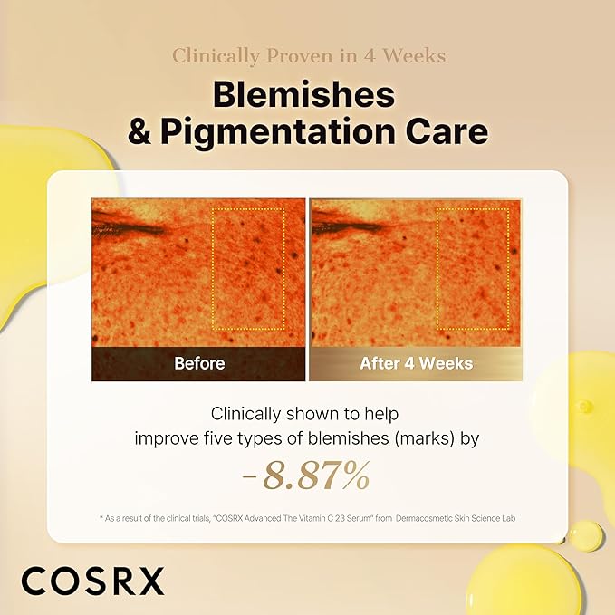 COSRX Advanced Pure Vitamin C 23% Serum with Vitamin E & Glutathione (Renewal), Korean Vitamin C Serum for Fine Lines, Uneven Skin Tone & Dull Skin, 0.7oz, Korean Skin Care