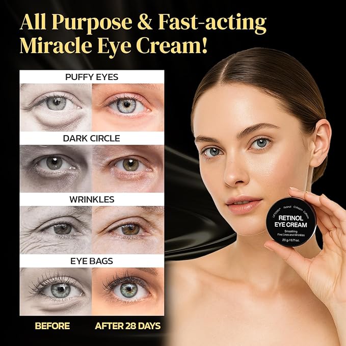 Men Retinol Under Eye Cream Anti Aging Eye Cream with Caffeine, Hyaluronic Acid, Peptides - for Dark Circles, Puffiness & Fine Lines, Firming & Brightening Under Eye - 20ml