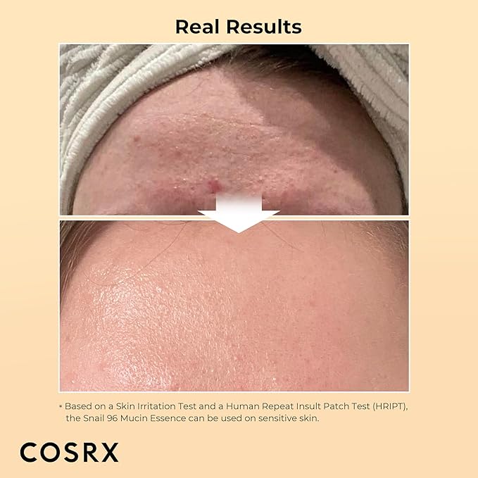 COSRX Skin Repair Set - Niacinamide 15% Serum + Snail Mucin 96% Essence, Hydrating and Pore Minimizer Serum for Glowy Skin