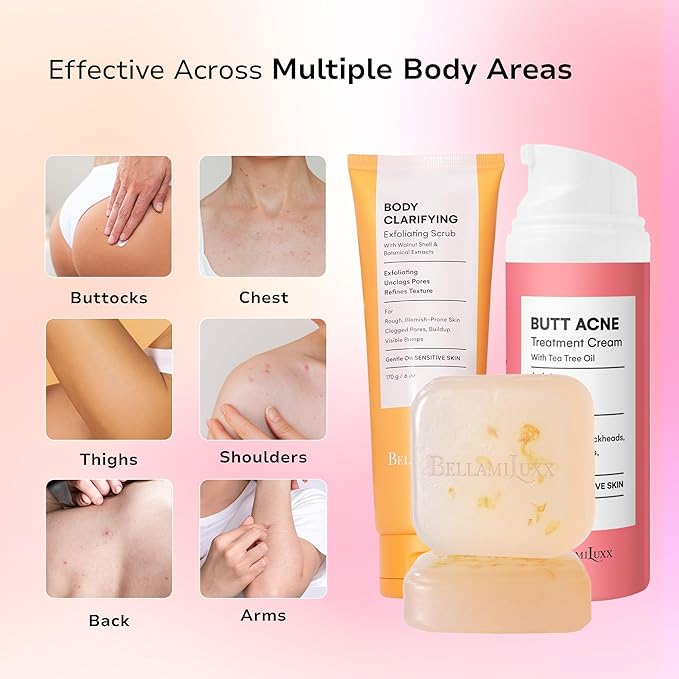 BellamiLuxx Butt Acne Treatment Set: Acne Soap Bar + Butt Treatment Lotion for Breakouts on Buttocks, Thighs, Back, Chest & Ingrown-Prone & Folliculitis-Prone Skin – Helps Reduce Body Breakouts