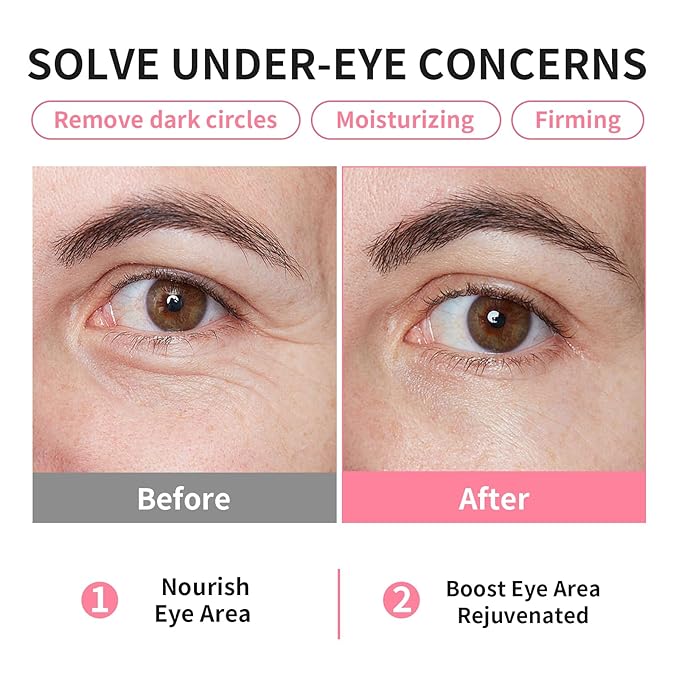 Bio-Collagen OK Eye Mask, Firming & Hydrating Under Eye Patches for Puffy Eyes and Dark Circles, Deep Moisturizing & Soothing Eye Mask for Women and Men - 6 Pairs, Mystery White