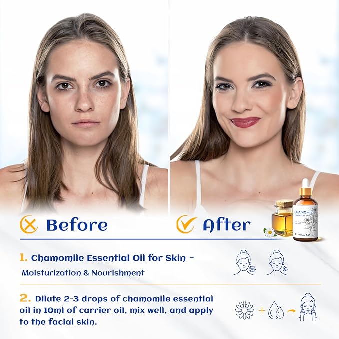 HIQILI 30ML Chamomile Essential Oil, Chamomile Oil for Diffuser, Skin, Soap, Shampoo - 1.01 Fl Oz | Keeping Space Fresh, Relaxing, Can be Used for Skin, Well with Base Materials to Soaps and More -30mL / 1.01 fl oz