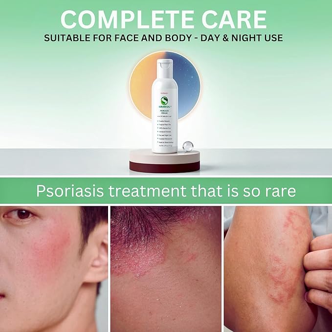 SORARESAL Psoriasis Cream - Comfort Remedy with Safflower Oil, Coconut Oil and Salicylic Acid – Eczema Cream for Itchy, Flaky Skin and Eczema Relief