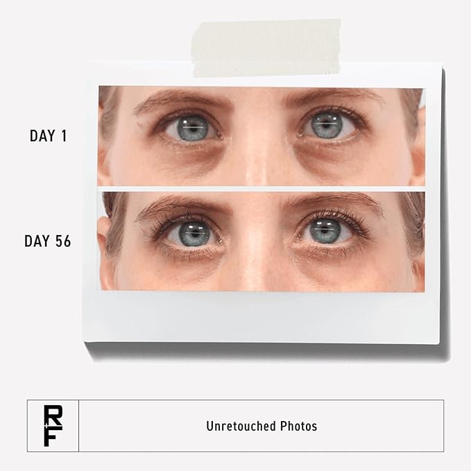 RODAN + FIELDS Active Hydration Bright Eye Complex | 15ml | Moisturizing Under Eye Cream for Dry Skin | Eye Treatment for Refreshed Appearance | Skincare