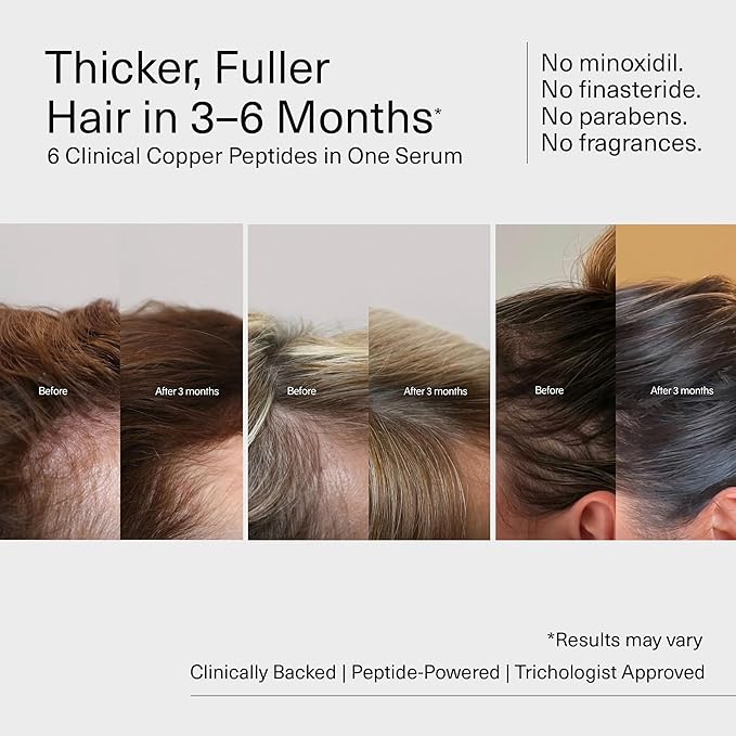 Bloom Clinically Copper GHK-CU Peptide Hair Serum for Hair Growth - Non-Greasy & Lightweight Advanced Multi Copper Peptides for Thinning Hair - Promotes Fullness, Reduces Shedding - Made in USA