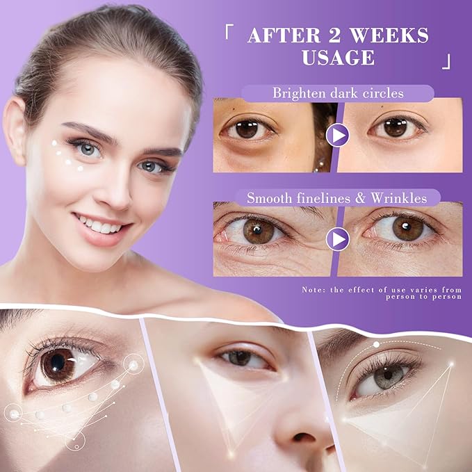 Eye Cream, Retinol Eye Cream for Dark Circles, Puffiness Anti Aging, With Hyaluronic Acid, Peptides, Caffeine Reduces Bags, 1234