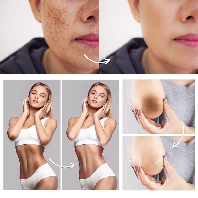 FAMIROSA Intimate Area Dark Spot Corrector: Underarm Cream for Armpit, Knees, Elbows, inner Thigh, Private Parts - Intimate Skin Cream 50 ml