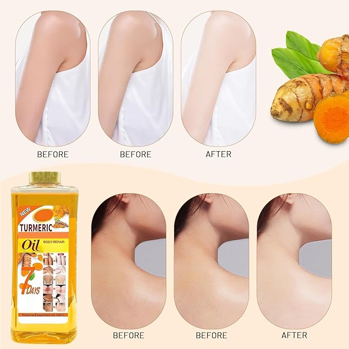1000ml Turmeric Oil for Skin Brightening - Organic Turmeric Oil for Face - Soft 7 Body Oil, Moisturizing