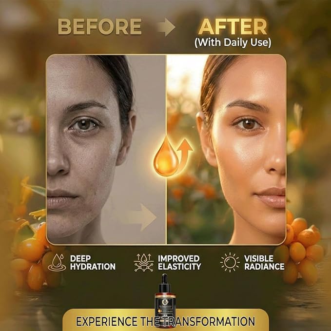 Organic Sea Buckthorn Oil Cold Pressed - 100% Pure Seabuckthorn Oil for Face, Skin & Hair | Anti-Aging, Acne & Dry Skin Care