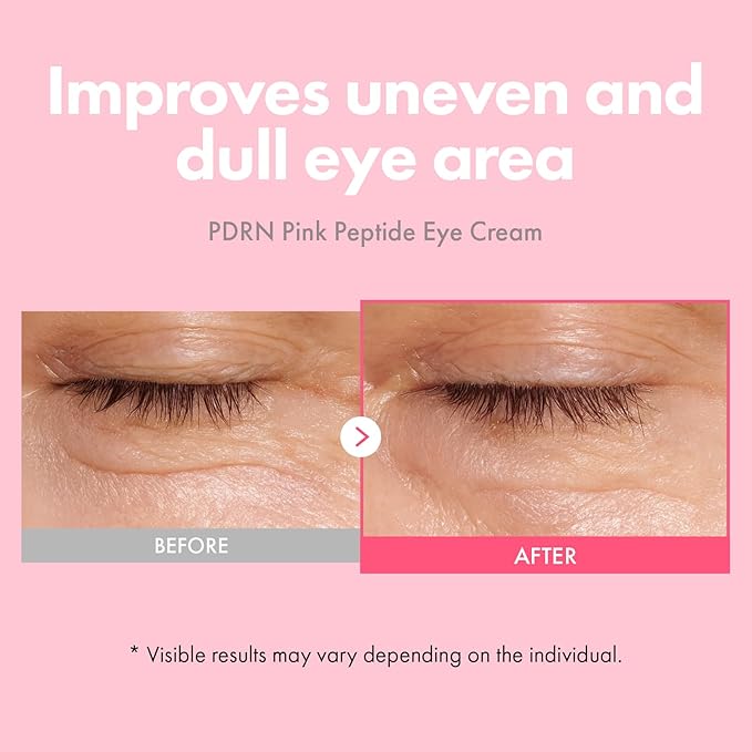 TOSOWOONG PDRN Pink Peptide Eye Cream with Salmon DNA PDRN 5,000ppm, Anti Aging Formula with Caffeine & Liposome Retinol for Fine Lines, Dark Circles and Wrinkles, Korean Skincare, 30ml / 1.01 fl.oz.