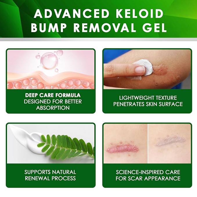 Tobcharm Advanced Keloid Scar Care Gel, Silicone Gel for Appearance of Keloid Scars & Skin Marks, Scar Smoothing Gel for Ears, Face & Body, 2-Pack (2×30g)