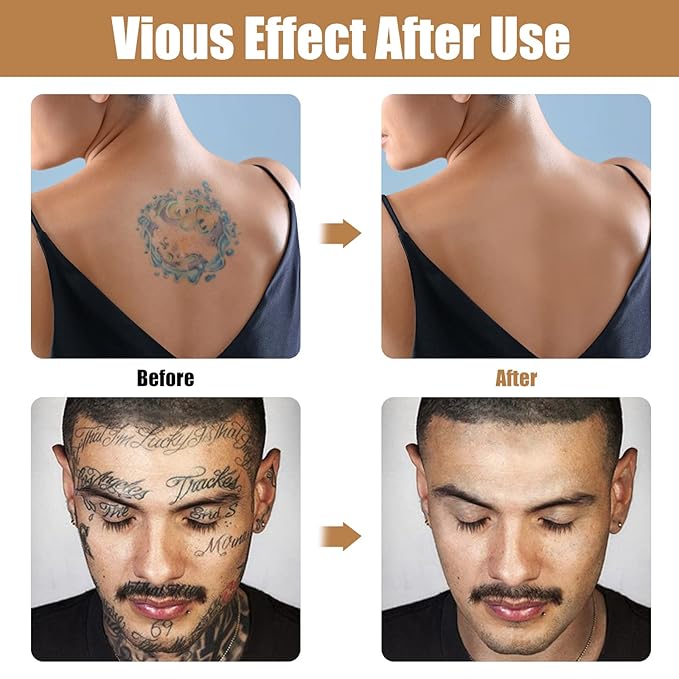 Tattoo Cover Up, 2 Colors Waterproof & Sweatproof Tattoo Cover Up Makeup, Long Lasting and Invisible Body Makeup Suitable for Vitiligo, Dark Spots, Scars-Natural