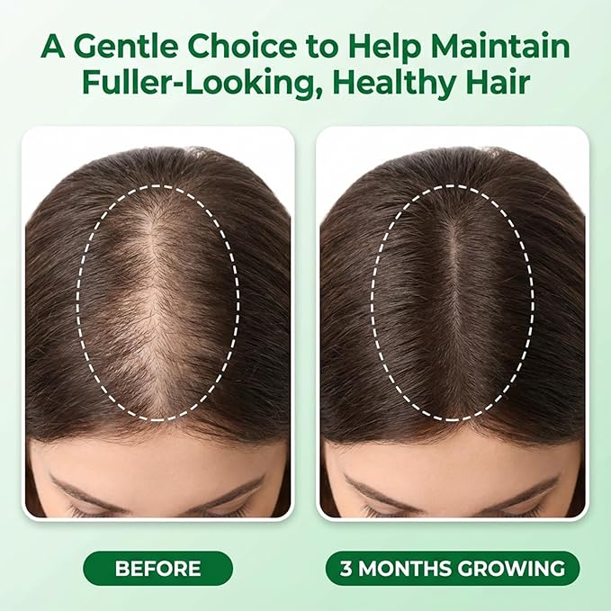 Hair Growth Care Serum Roll-On with Rosemary, Niacinamide, Ginger, batana & Castor Oil, Nourishes Scalp for Thicker-Looking, Vibrant Hair, Light Camellia Scent, 30ml/1.01 fl.oz