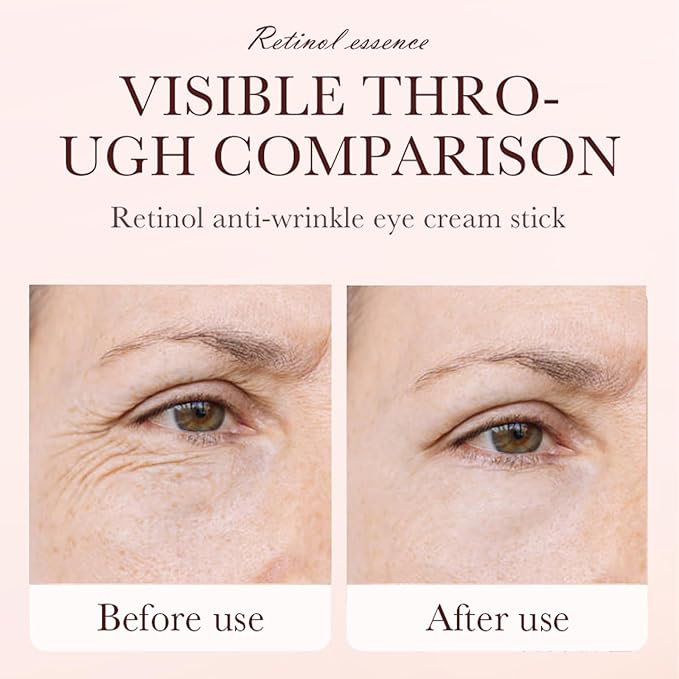 Retinol Eye Cream Stick, Anti Aging Retinol Eye Cream for Dark Circle, Wrinkles In 3-4 Weeks, Under Eye Cream Hydrating Revive Glow Eye Balm Stick for Puffiness and Bags Reduces Fine Lines