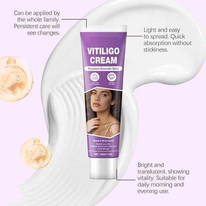 Vitiligo Cream, Vitiligo Treatment Cream， Reduce White Spots，Easy to Use