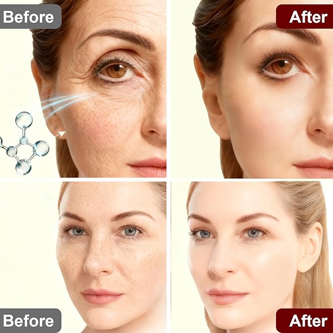 Calcium Multi Balm Stick for Face, Eyes, Lips & Neck Area, Calcium Volume Multi Balm Stick for Hydrating, Firming and Soothing with Adenosine, Hydrolyzed Elastin, Vitamin C & E, 9 g