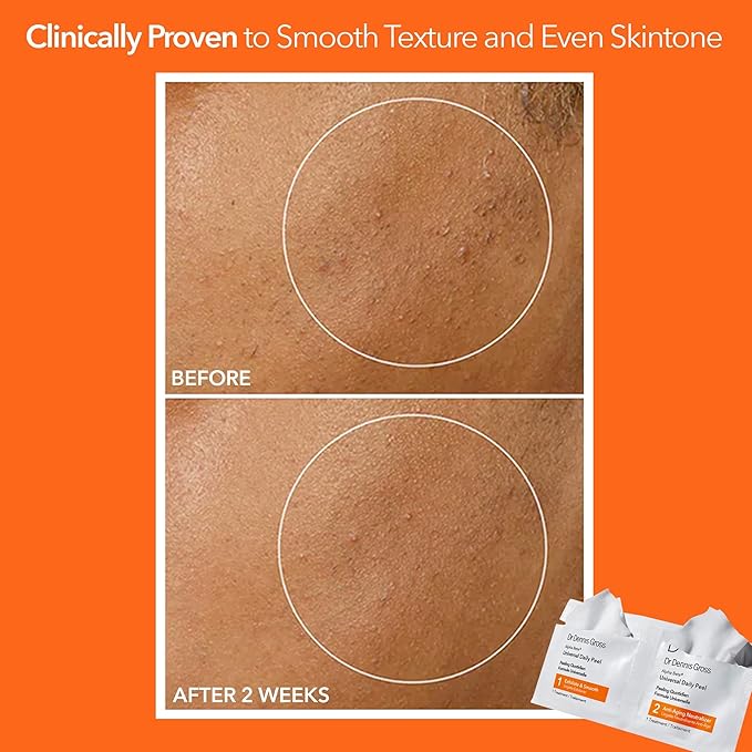 Dr Dennis Gross Alpha Beta Universal Daily Peel: for Uneven Tone or Texture and Fine Lines or Enlarged Pores, (30 Treatments)