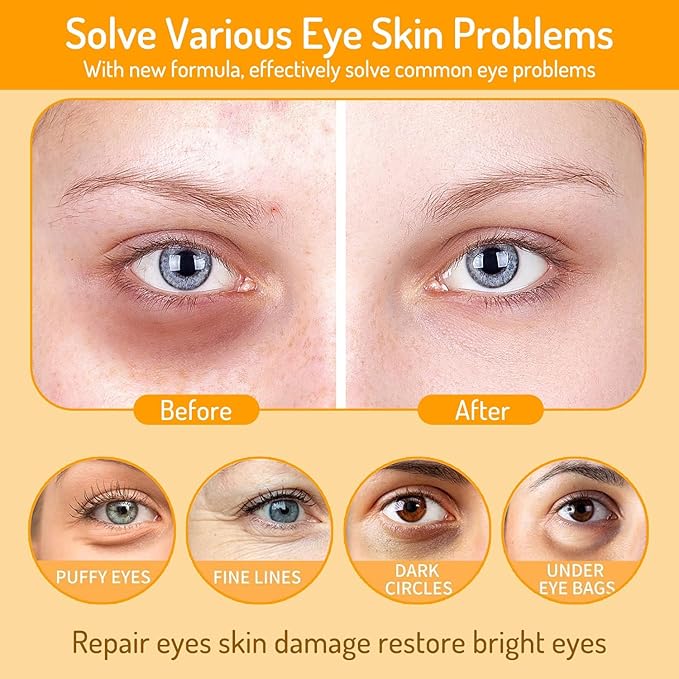 Eye Patches for Dark Circles and Puffiness with Retinol, Collagen, Vitamin C, Hyaluronic Acid - 60pcs Anti Aging Under Eye Masks for Undereye Brightening, Hydrating, Anti-Wrinkle & Cooling (Golden)